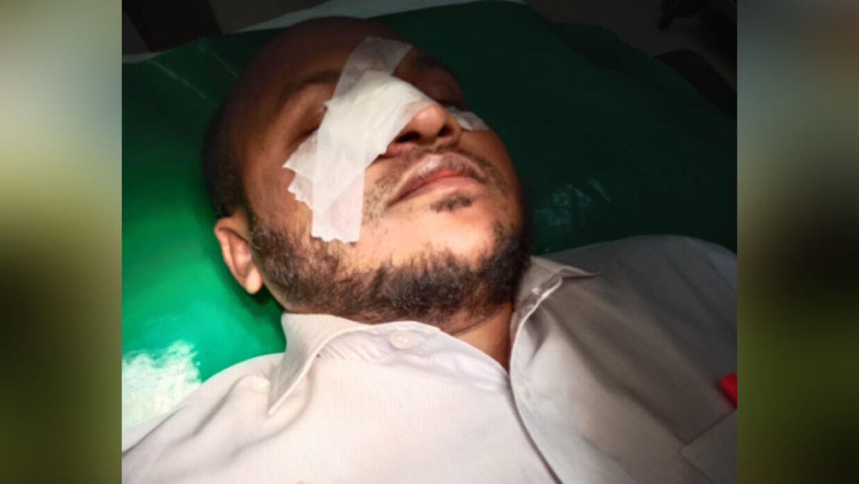 জামায়াতপন্থী আইনজীবীদের ওপর বিএনপিপন্থীদের হামলা, আহত তিন